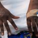 Ghana records 21 new Mpox cases, total now 218 – GHS
